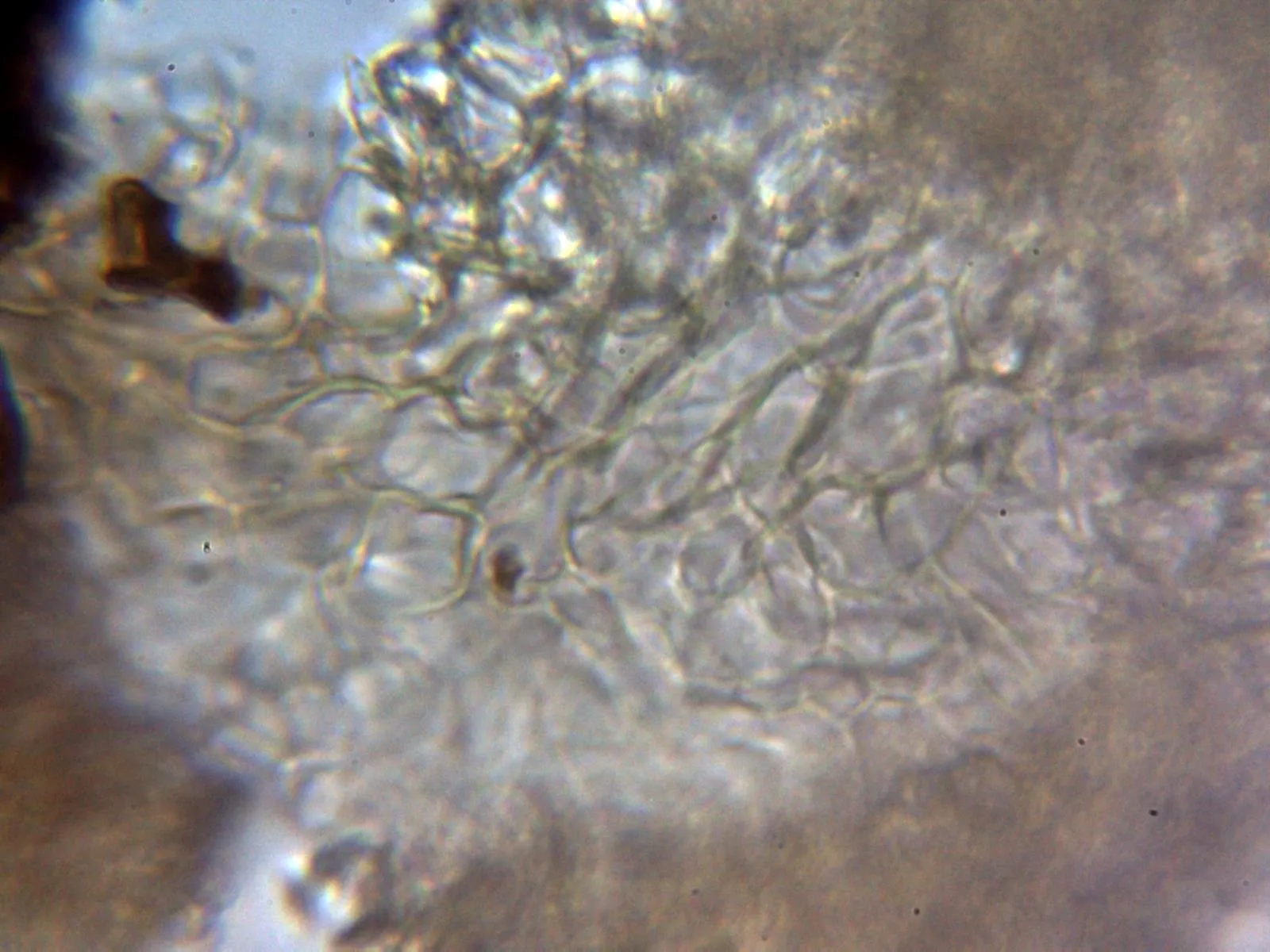 Microscopía de Tuber aestivum - 10 - Peridio 1